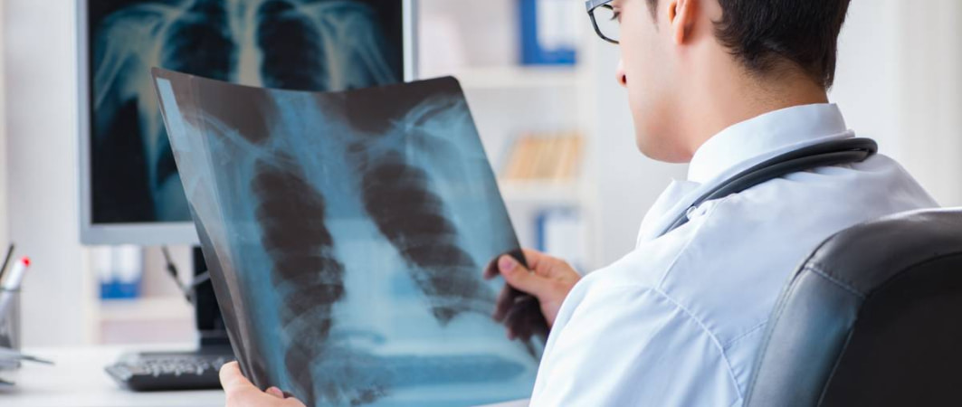 Pljučni rak - Triglav Zdravje